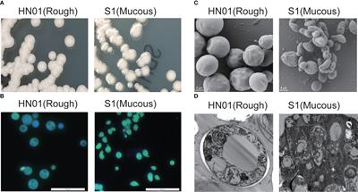 Integration of transcriptomics, proteomics, and metabolomics data for the detection of the human pathogenic Prototheca wickerhamii from a One Health perspective